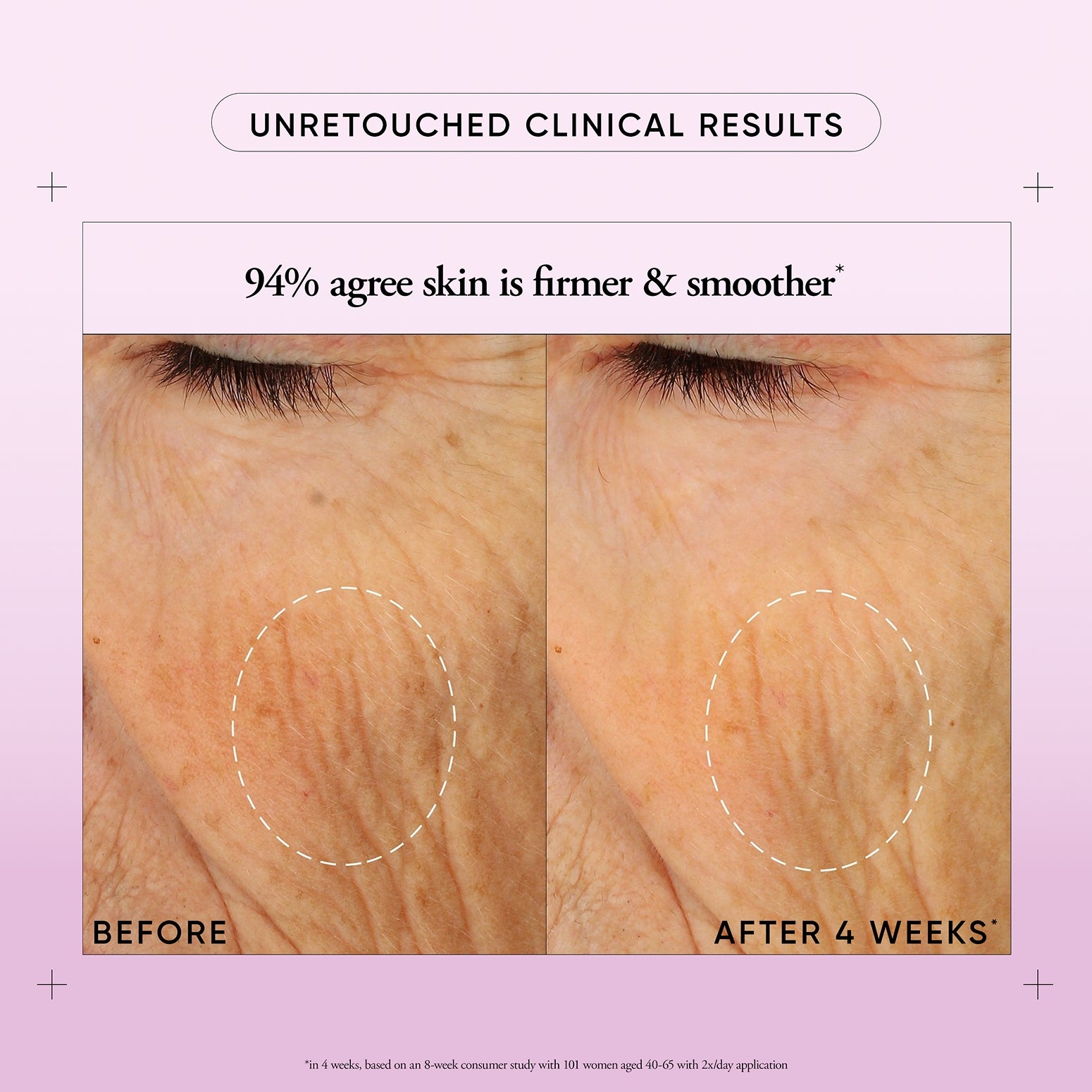 Travel-Size Retinol Cream for Face & Neck | Anti-Aging Skincare On