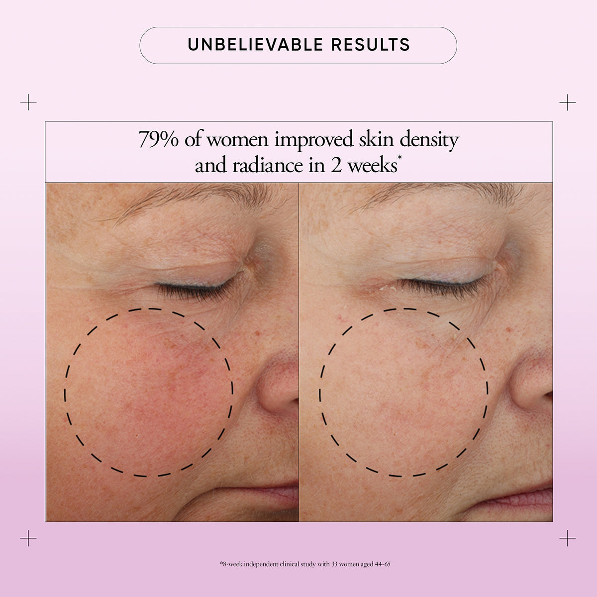 multi-rejuvenating cream broad spectrum spf 30 | philosophy