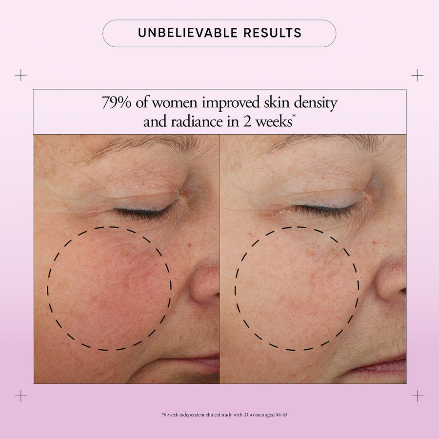 multi-rejuvenating cream broad spectrum spf 30 product image contains text: unbelievable results, 79% of women improved skin density and radiance in 2 weeks*, *8 week independent clinical study with 33 women aged 44-65